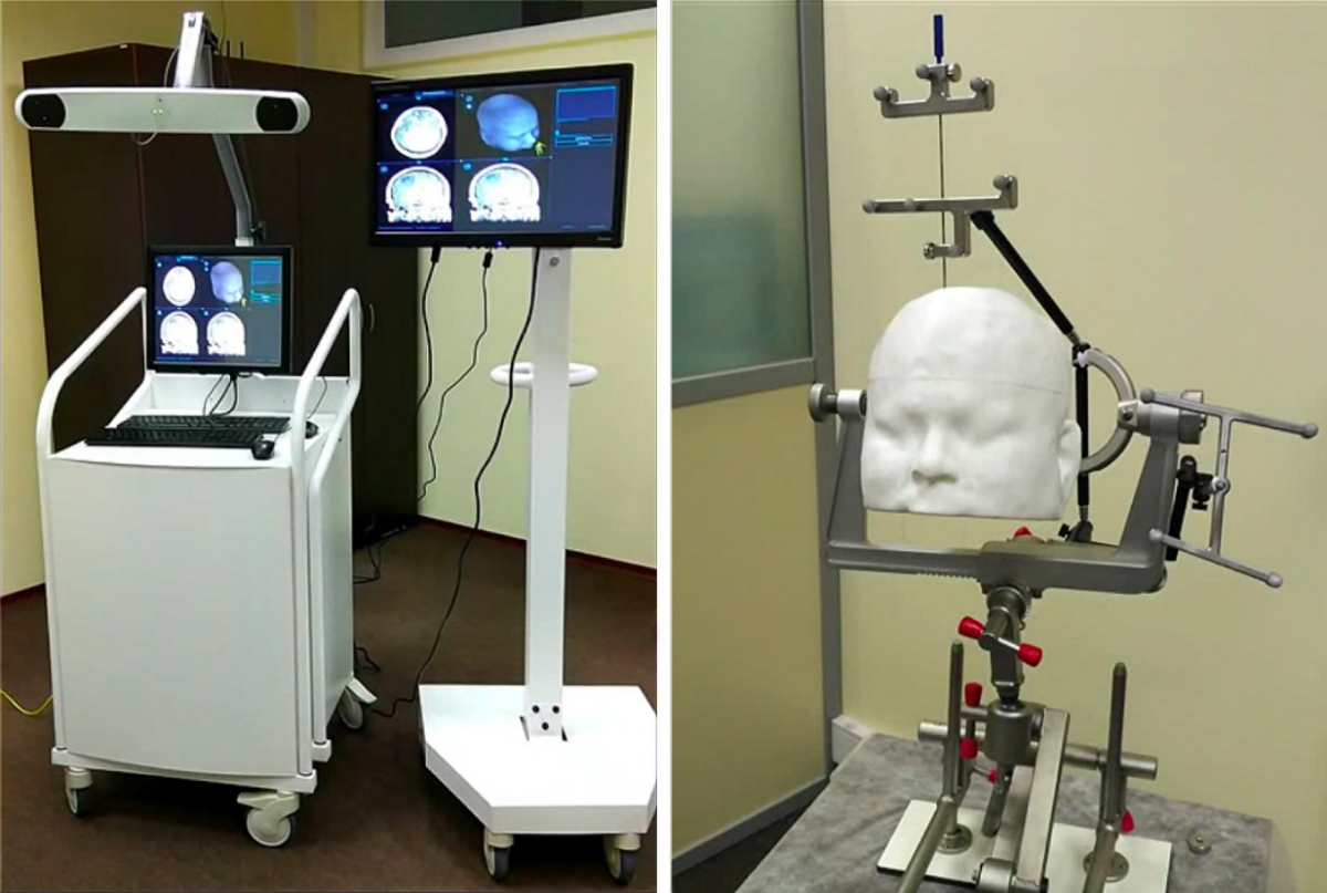 The working prototype of neuronavigator